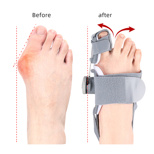 Bunion Corrector