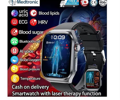 Electrocardiogram smart watch