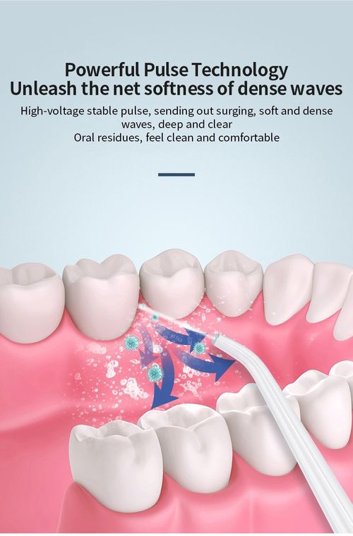 Water Flosser Portable Cordless Oral Irrigator 3 Modes Weak Strong Pulse IPX7 Waterproof Rechargeable Dental Cleaner 360° Rotatable Nozzle 4 Replaceable Tips for Travel Home