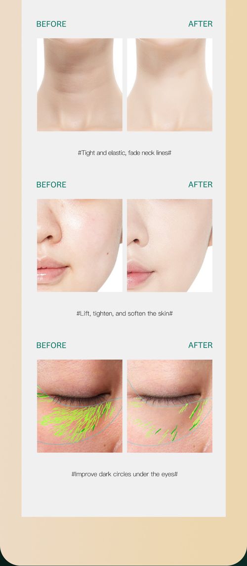 Firming & Shaping Facial Device – Lift, Tighten & Rejuvenate Skin