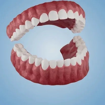 Haute Couture Full Denture Set