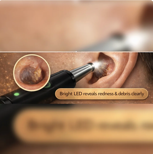 Wireless cleaning endoscope for high-definition ear cleaning（Black - Premium Edition + 9-Piece Set ）