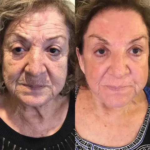 VenomCare™ Target Pain. Restore Movement.