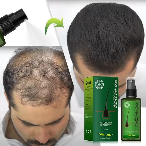 Choose It for Scalp Repair! Hair Care Serum – Strengthens Strands & Deeply Nourishes Hair Roots
