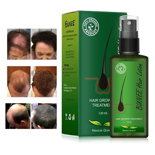 Choose It for Scalp Repair! Hair Care Serum – Strengthens Strands & Deeply Nourishes Hair Roots