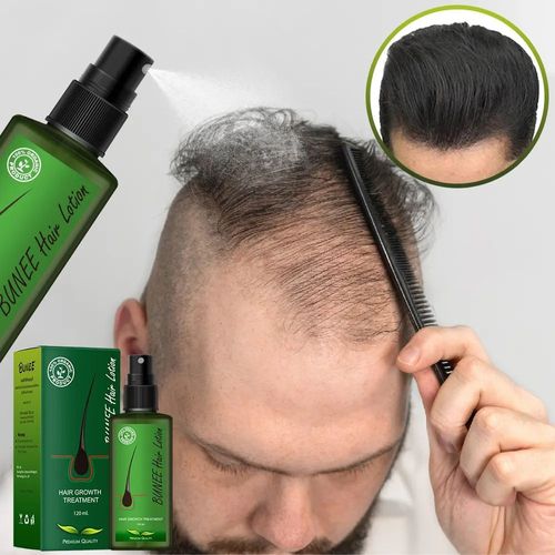 Choose It for Scalp Repair! Hair Care Serum – Strengthens Strands & Deeply Nourishes Hair Roots