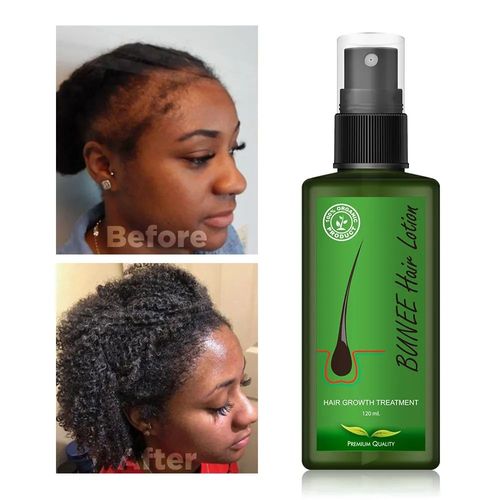 Choose It for Scalp Repair! Hair Care Serum – Strengthens Strands & Deeply Nourishes Hair Roots