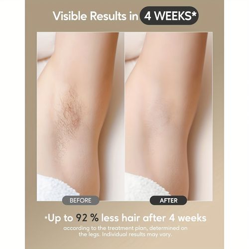 Hair Removal with Ice Cooling Function