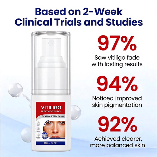 VITILIGO™ Vitiligo Treatment Spray,Buy 1 Get Free 1