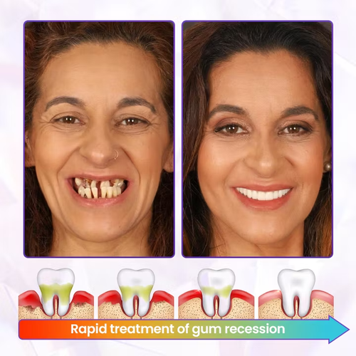 Oralhoe® BeeRenew Advanced Gum Healing Toothpaste 🔥