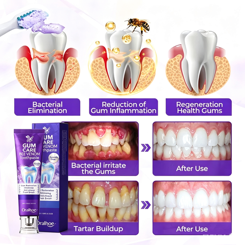 Oralhoe® BeeRenew Advanced Gum Healing Toothpaste 🔥