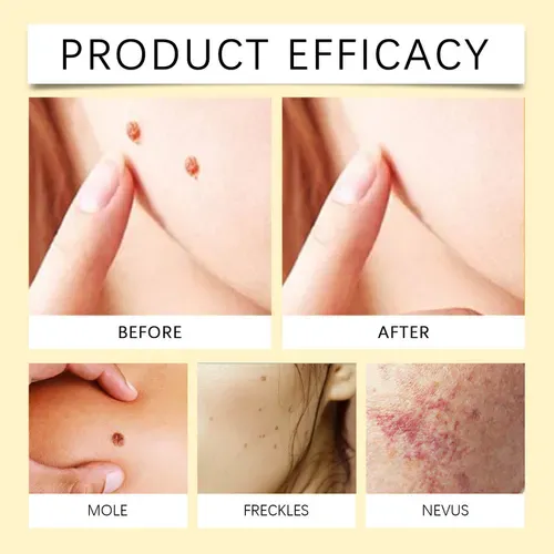 London Clinic NHS Official Made and Shipped from UK Golden Elixir Botox Bee Venom Skin Restoration