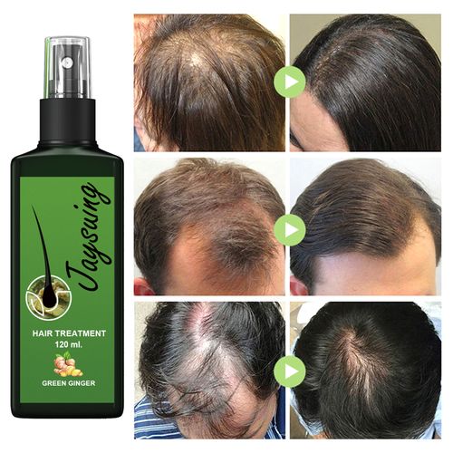 Jaysuing Spray Capilar - Nutrición Suave para Cuero Cabelludo, Hidratación y Suavidad Intensa para el Cabello