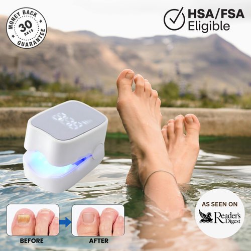 🏖️MUST HAVE THIS SUMMER🔥 ClearNail Pro™ - Nail Fungus Laser Device