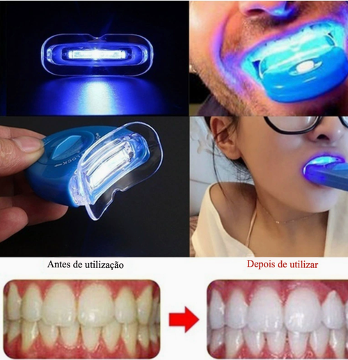 Acelerador de clareamento de dentes com luz LED para clareamento dental, laser cosmético para dentes.