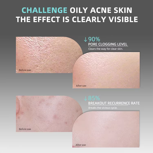 Mediheal (Korea) Centella Asiatica Soothing & Repairing Cotton Pads — Vitamin-Infused Hydrating & Moisturizing Sheet Mask Pads