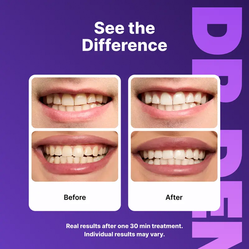 DRDENT Purple Teeth Whitening Strips - 42 Whitening Sessions - Safe for Enamel - Non Sensitive Teeth Whitening - Peroxide-Free