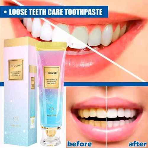 Whitening Toothpaste