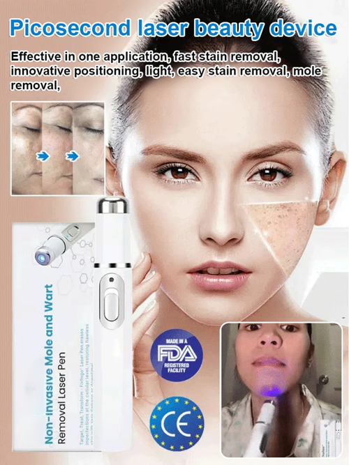 Laser skin spot removal beauty device