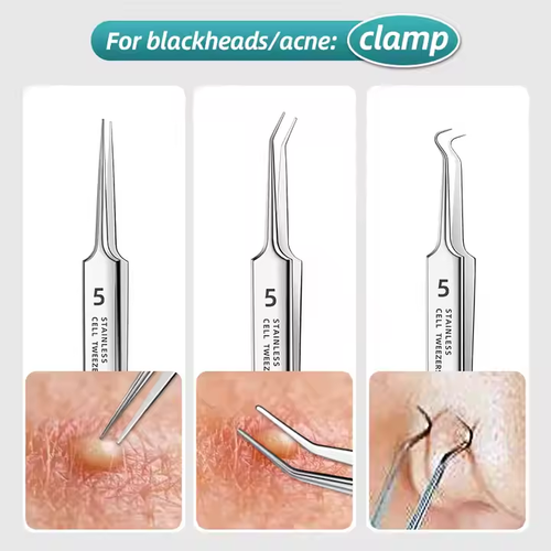 8 - Piece Acne Removal Tool Kit: Blackhead & Pimple Care