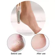 The latest electric foot file hard skin remover