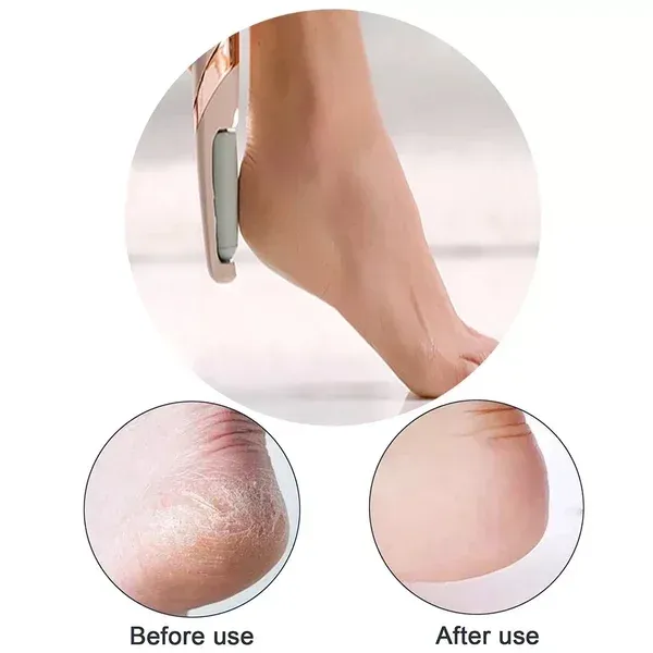 The latest electric foot file hard skin remover