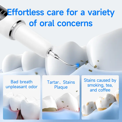MDLIKE Plaque Tartar Remover for Teeth, Dental Calculus Remover Teeth Cleaning Kit with LED Light & 5 Adjustable Modes Tartar Remover-Cleansing Mouth Care Father's Day Gift Long Battery Life Waterproof Oral