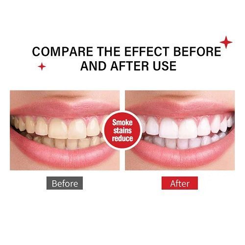 Dental Calculus Remover Toothpaste Teeth Whitening Remove Plaque Stains Improve Yellow Teeth Cavity Fresh Breath Oral Cleaning