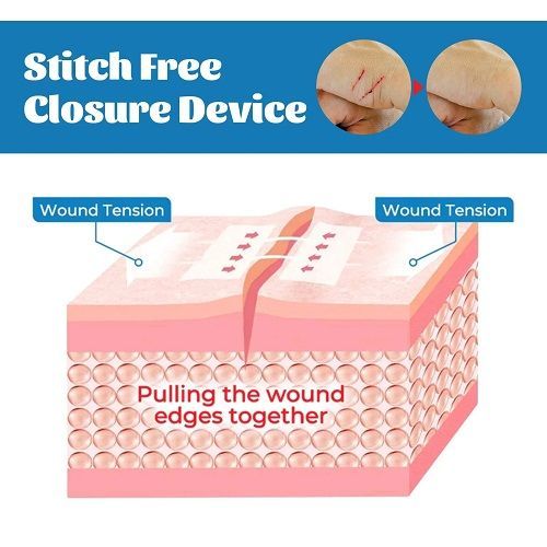 1Pcs Portable Wound Closure Patch Painless Suture Zipper Band-Aid Repair Wounds Waterproof Stitch Free Hemostatic Sticker