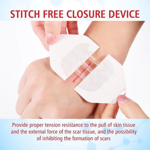1Pcs Portable Wound Closure Patch Painless Suture Zipper Band-Aid Repair Wounds Waterproof Stitch Free Hemostatic Sticker
