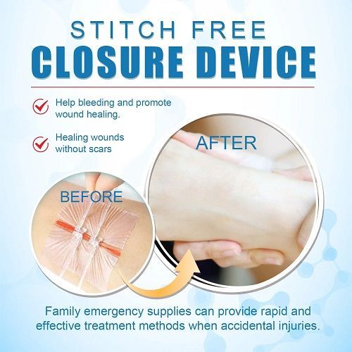 1Pcs Portable Wound Closure Patch Painless Suture Zipper Band-Aid Repair Wounds Waterproof Stitch Free Hemostatic Sticker