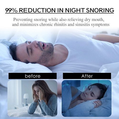 100PCS Stop Snoring Patch Nose Breathing Correction Promoting Better Breath Improve Sleeping Portable Night Sleep Mouth Orthosis Tape