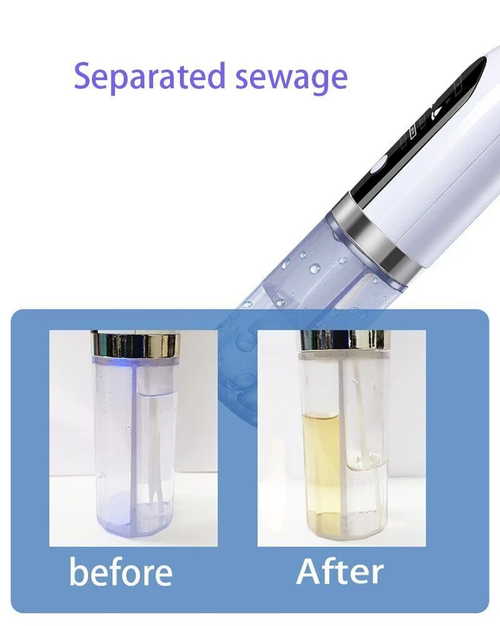 Electric Blackhead Remover Pore Vacuum Face Cleaner Pimple Black Head Removal