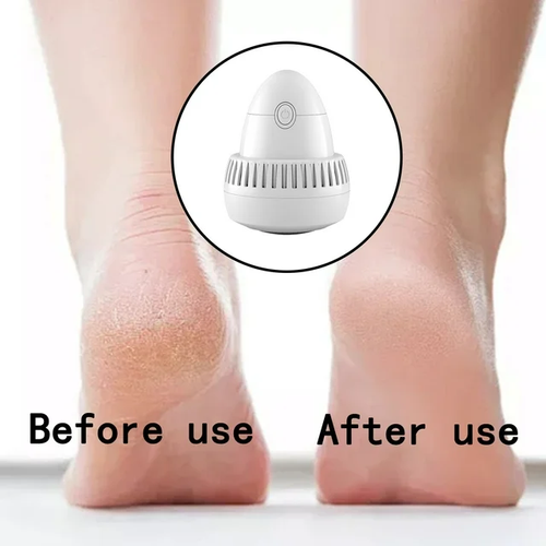 Wireless Portable Electric Foot Grinder, Electric Foot Callus Remover, 2 Speed Levels & 2 Grinding Heads, Skin Trimmer Dead Skin