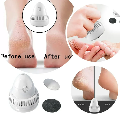 Wireless Portable Electric Foot Grinder, Electric Foot Callus Remover, 2 Speed Levels & 2 Grinding Heads, Skin Trimmer Dead Skin