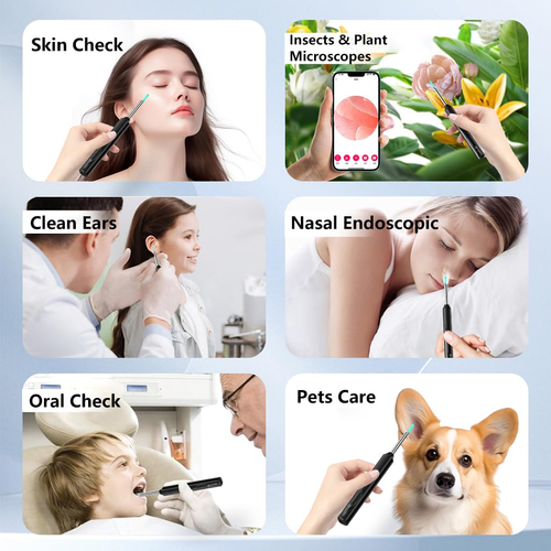 Eptchn 1080P Wireless Otoscope Ear Wax Removal Camera