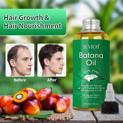 Battana essential oil