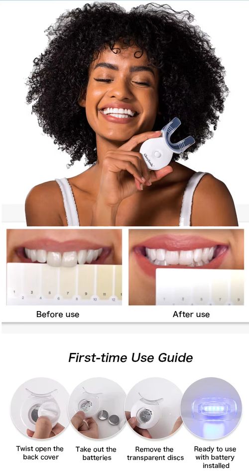 Gel Especial Kit para Limpeza Dental caseiro Dispositivo para Clareamento Dental