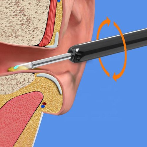 Wireless Visual Electric Ear Cleaner Machine Endoscope Ear Pick HD Camera Ear Wax Cleaning Kit