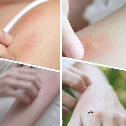 Ultrasonic powerful mosquito repellent wristband