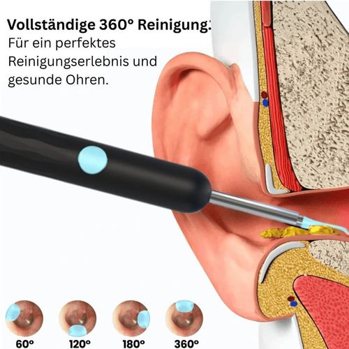 ⏳Limited time 49% discount💥🔍 Ear canal cleaning has never been clearer! Smart visual ear-cleaning spoon – safe, precise and gentle on the ears 🦻✨