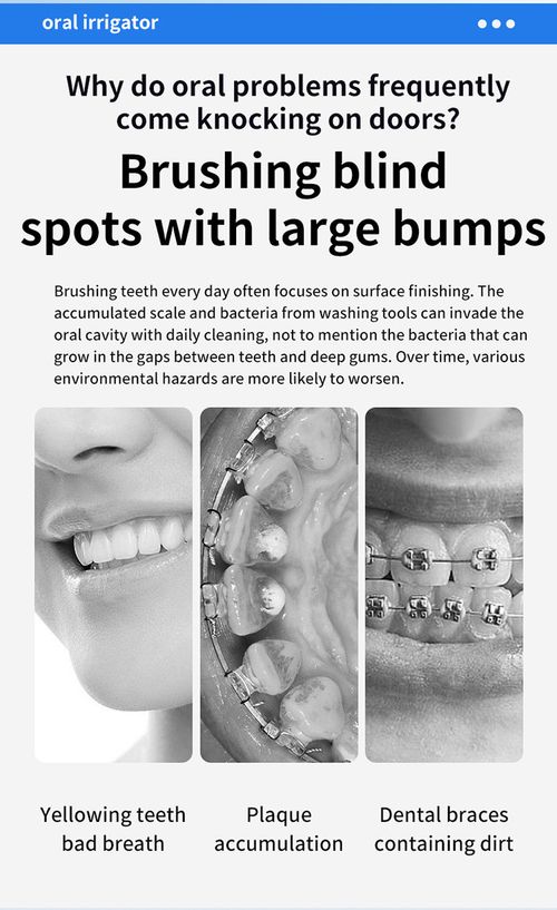 2026 New Portable Water Flosser, Electric Oral Irrigator, Handheld Dental Cleaner for Tartar Removal