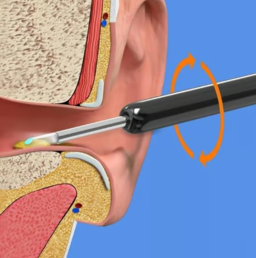 💘Wireless Bluetooth Visible Ear spoon😍