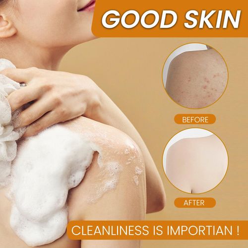 Kojic Acid Soap, Lemon Turmeric Soap, Turmeric Acid Soap, Kojic Acid Soap - Dark Spots, Skin Color Enhancement, Exfoliating (Kojic Acid)