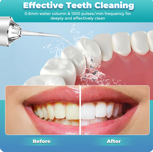 Water-Flosser-Teeth-Cleaner, Rechargeable - Waterproof, Portable Cordless Dental Oral Irrigator, Water flossers for Teeth, 3 Modes 4 Nozzles, for Home and Travel Elegant, Water Flosser for Braces