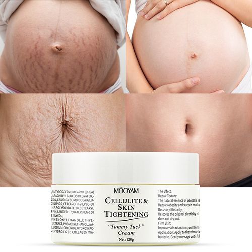 Stretch mark and scar repair cream for pregnancy