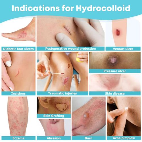 Artificial skin dressing