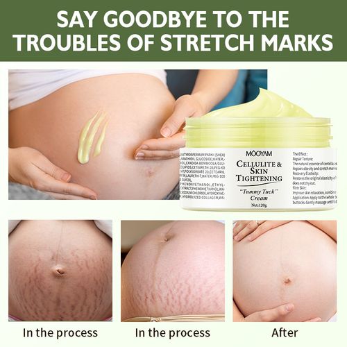 Stretch mark and scar repair cream for pregnancy