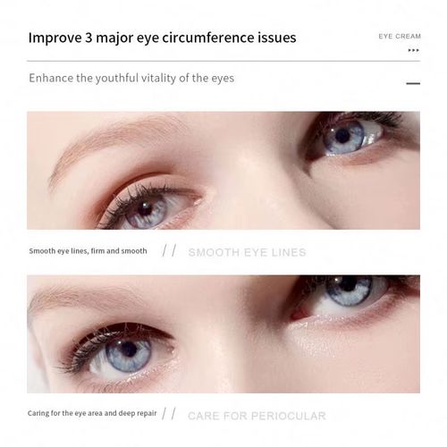 Snake Venom Eye Cream – Anti-Wrinkle & Eye Bag Treatment for Dark Circles, Puffiness & Fine Lines, Brightening Eye Cream 30g