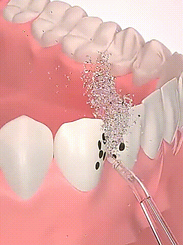 Portable Water Dental Floss Oral Irrigator